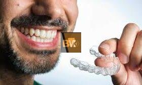 Aligners