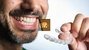 Aligners