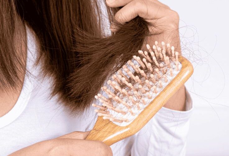 Hair Patches for Women