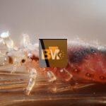 Lice Removal
