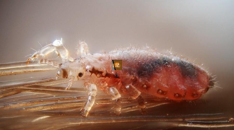 Lice Removal