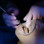 Tips for Braces and Aligners Maintenance