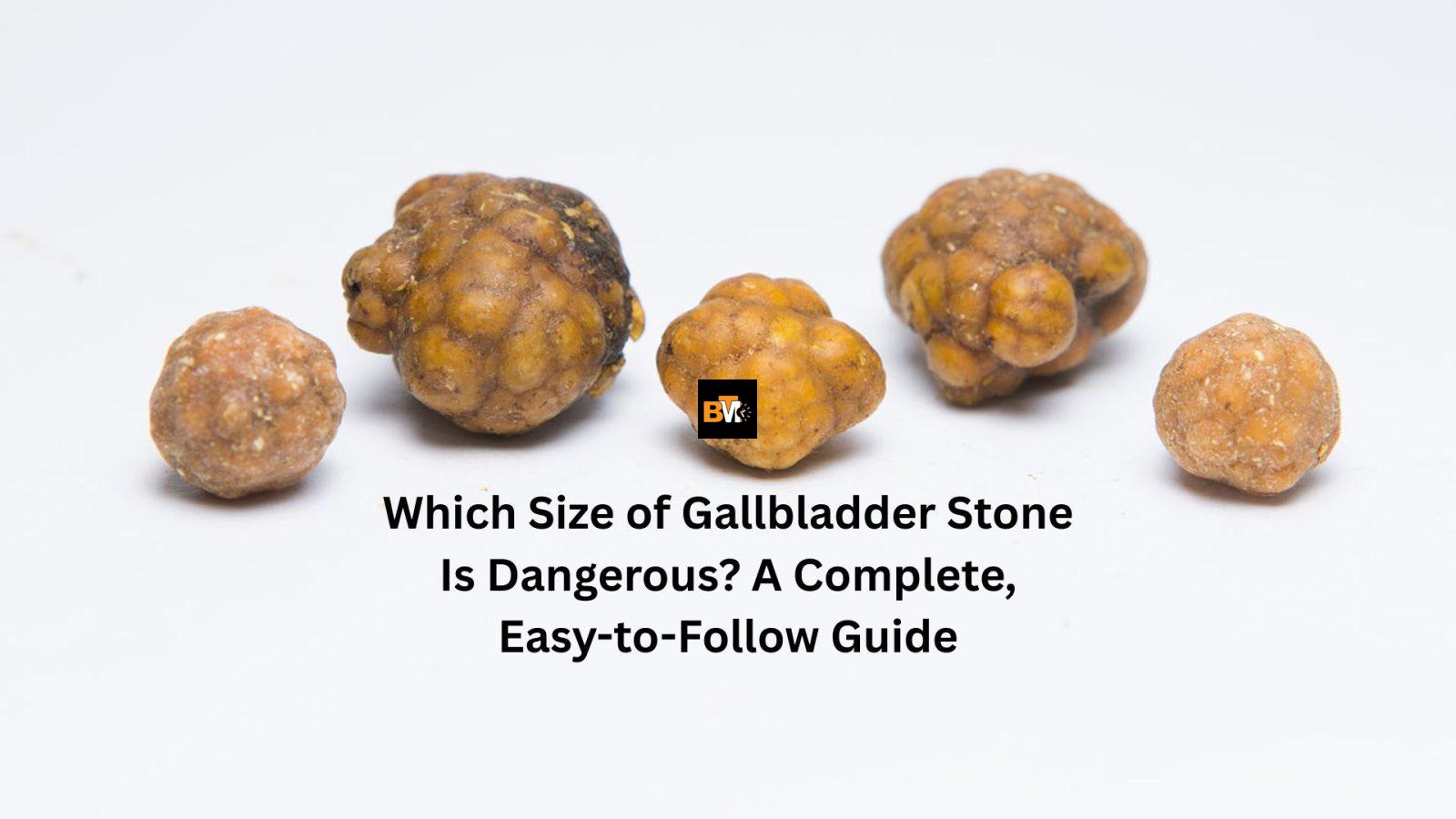 "which size of gallbladder stone is dangerous"