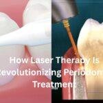 How Laser Therapy Is Revolutionizing Periodontal Treatment