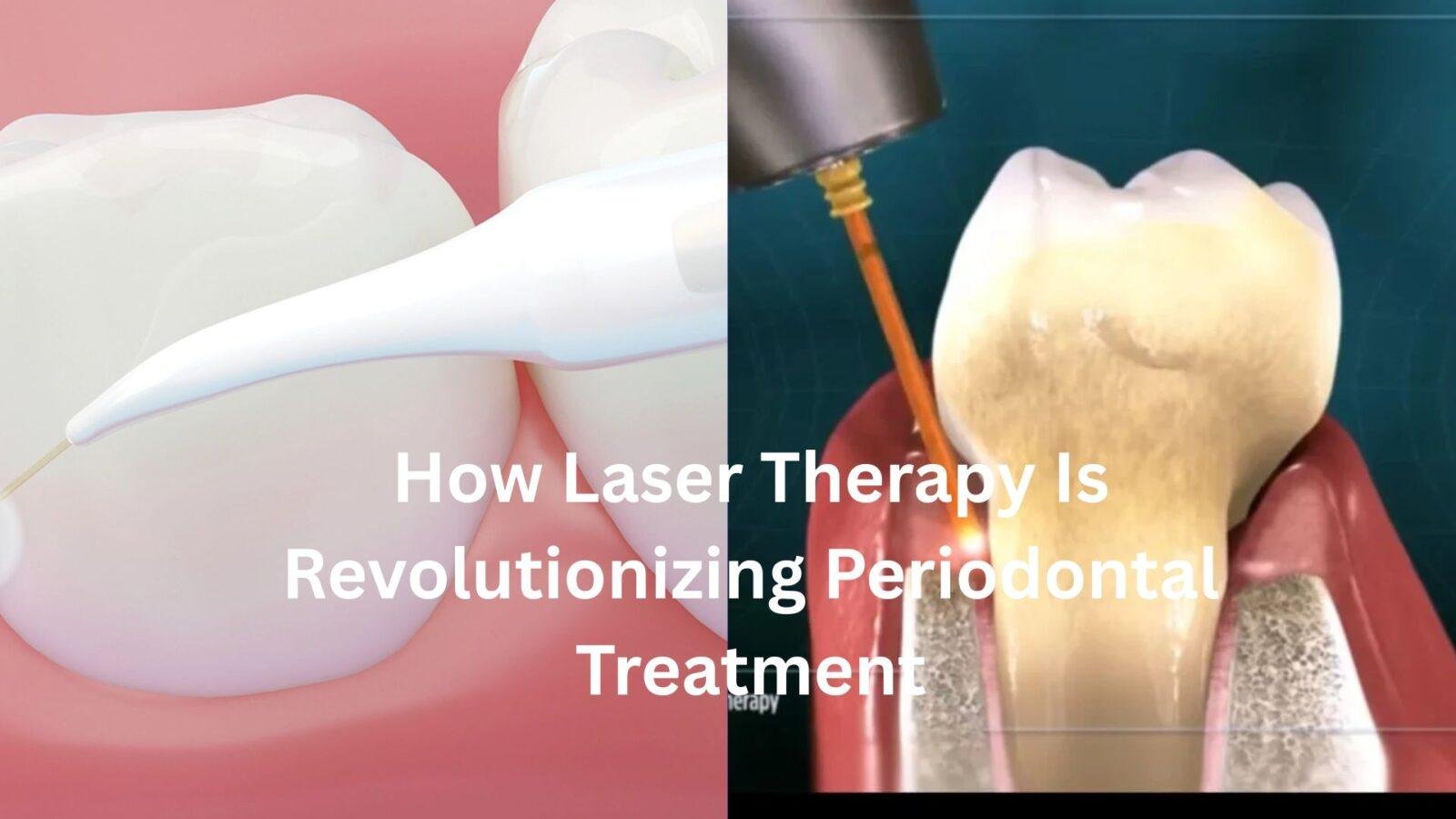 How Laser Therapy Is Revolutionizing Periodontal Treatment