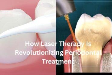 How Laser Therapy Is Revolutionizing Periodontal Treatment