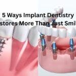 5 Ways Implant Dentistry Restores More Than Just Smiles