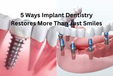 5 Ways Implant Dentistry Restores More Than Just Smiles