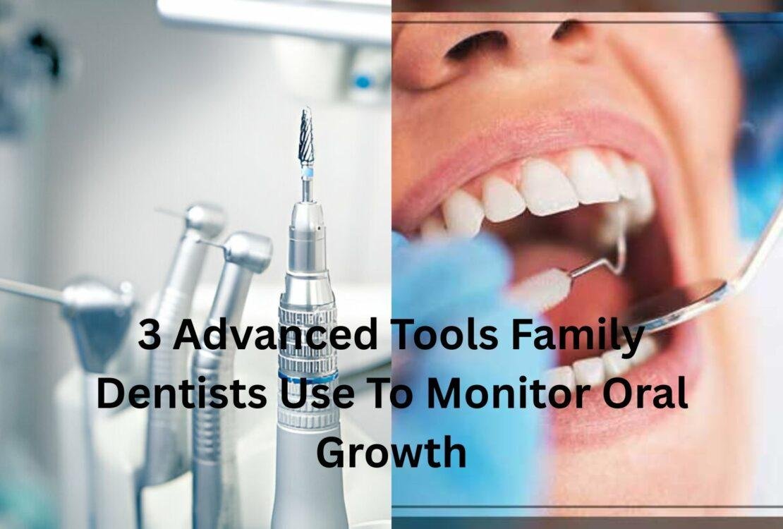 3 Advanced Tools Family Dentists Use To Monitor Oral Growth