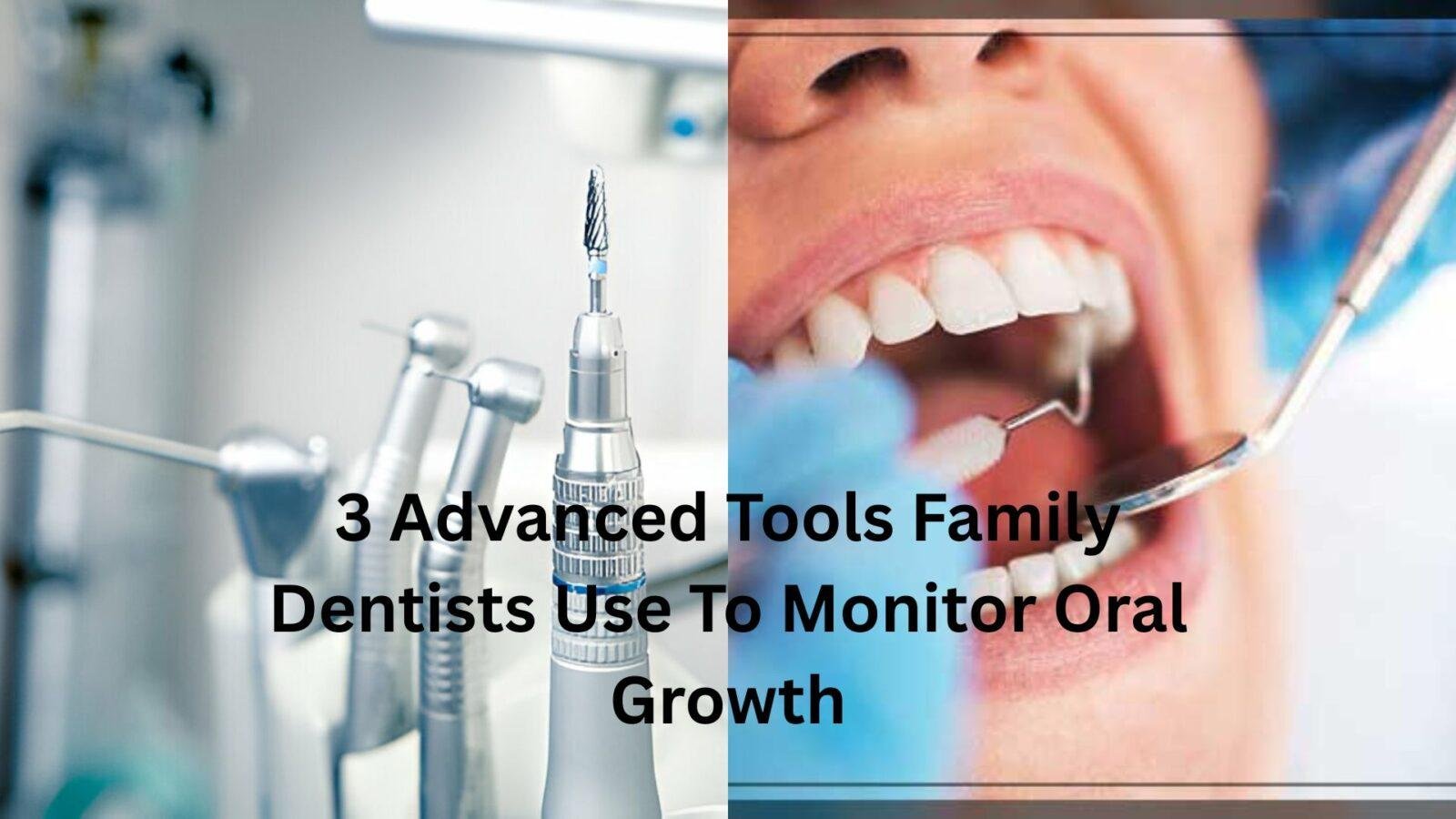3 Advanced Tools Family Dentists Use To Monitor Oral Growth