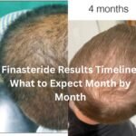 Finasteride Results Timeline: What to Expect Month by Month